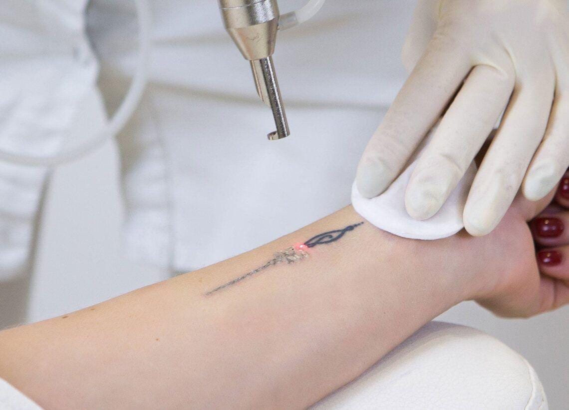 Pico Laser, карбоновый пилинг и удаление тату — I am ME Beauty Lounge, Bang Tao